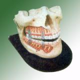 HUMAN UPPER AND LOWER JAW
